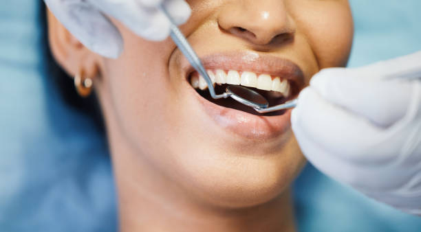 Best Emergency Dental Extractions in Inverness, CO